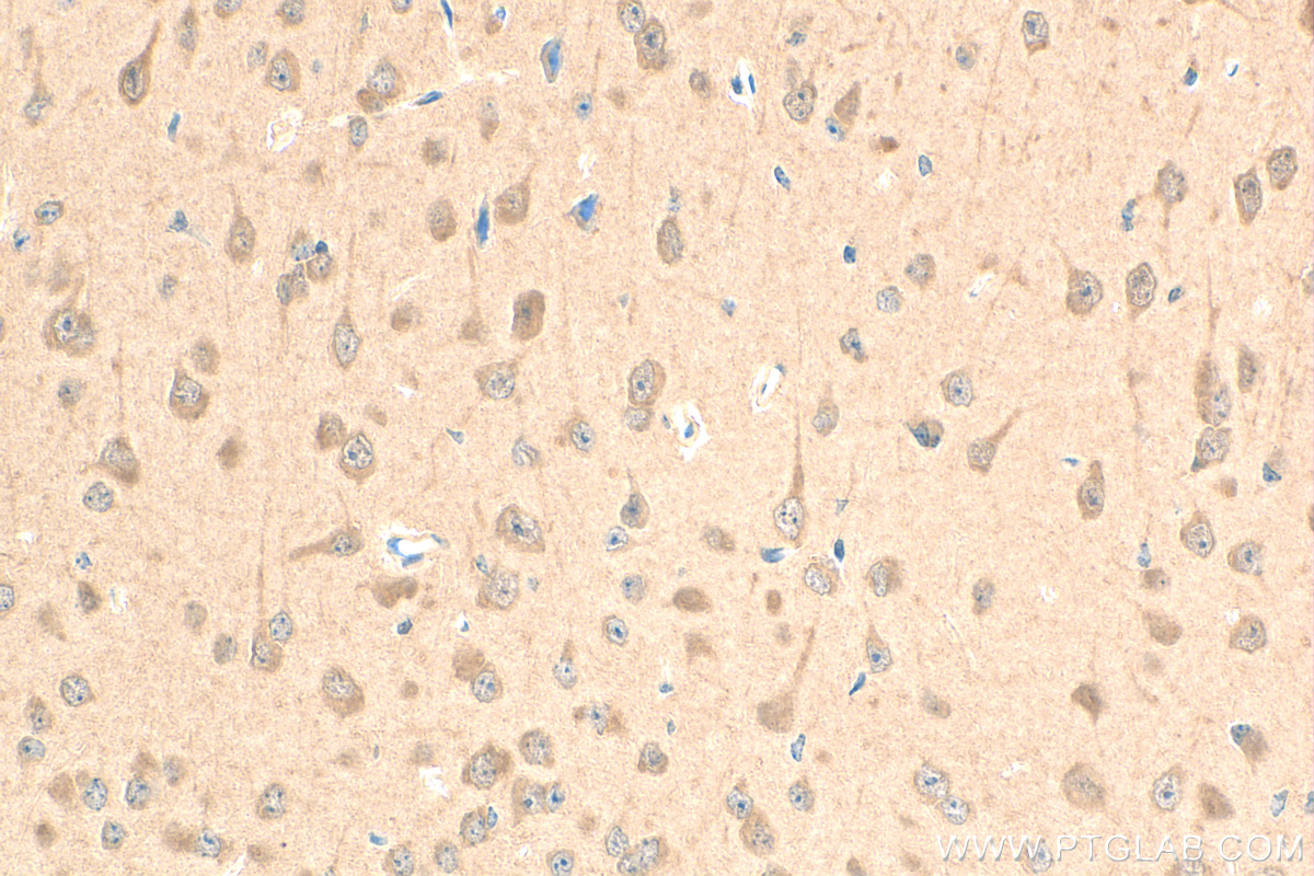 Immunohistochemistry (IHC) staining of mouse brain tissue using PPAR Gamma Recombinant antibody (81490-5-RR)