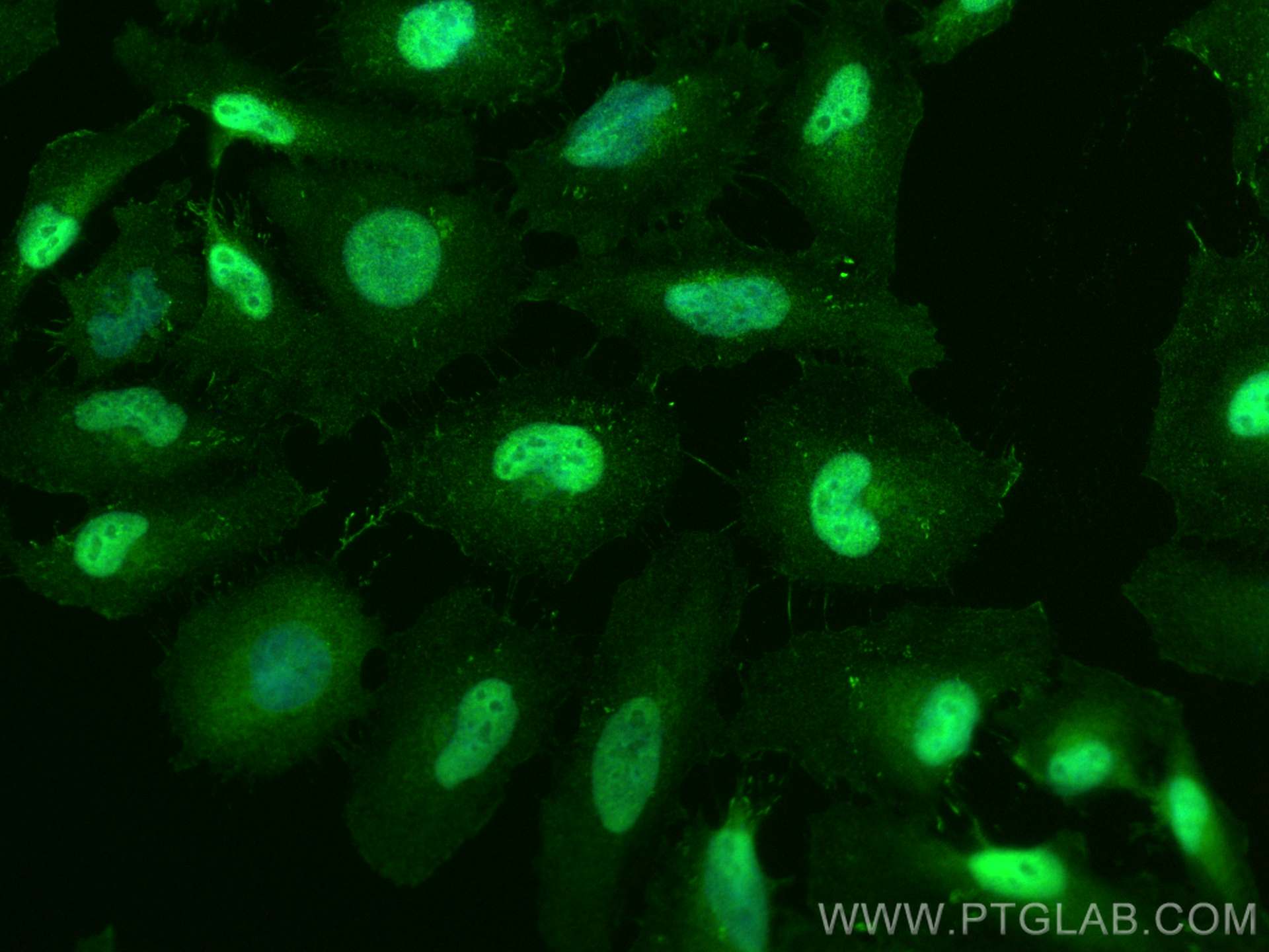 Immunofluorescence (IF) / fluorescent staining of HeLa cells using PPAR Gamma Monoclonal antibody (60127-1-Ig)