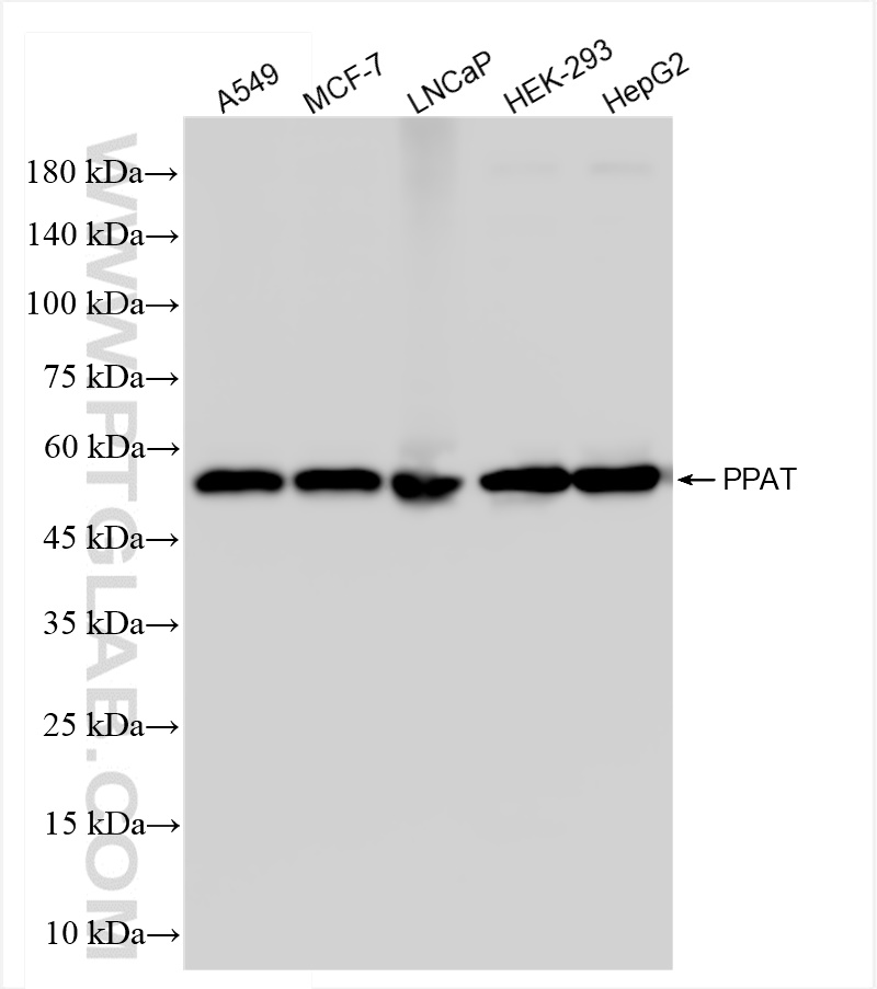 Western Blot (WB) analysis of various lysates using PPAT Recombinant antibody (85096-1-RR)