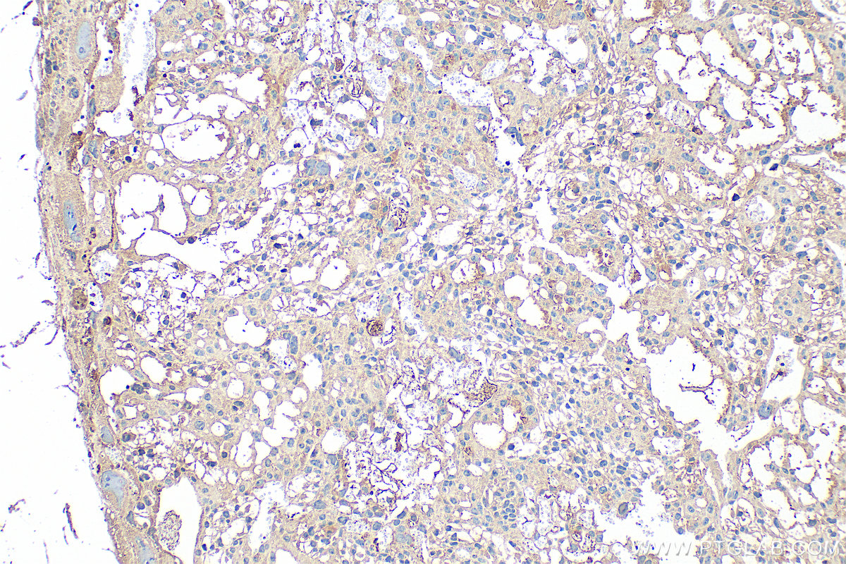 Immunohistochemistry (IHC) staining of mouse placenta tissue using CXCL7/PPBP Polyclonal antibody (13313-1-AP)