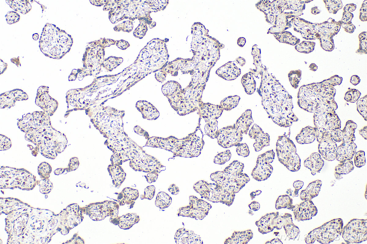 Immunohistochemistry (IHC) staining of human placenta tissue using CXCL7/PPBP Polyclonal antibody (13313-1-AP)