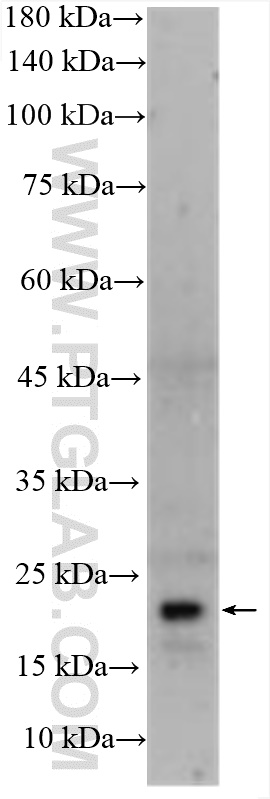 Western Blot (WB) analysis of human placenta tissue using PPCDC Polyclonal antibody (16270-1-AP)