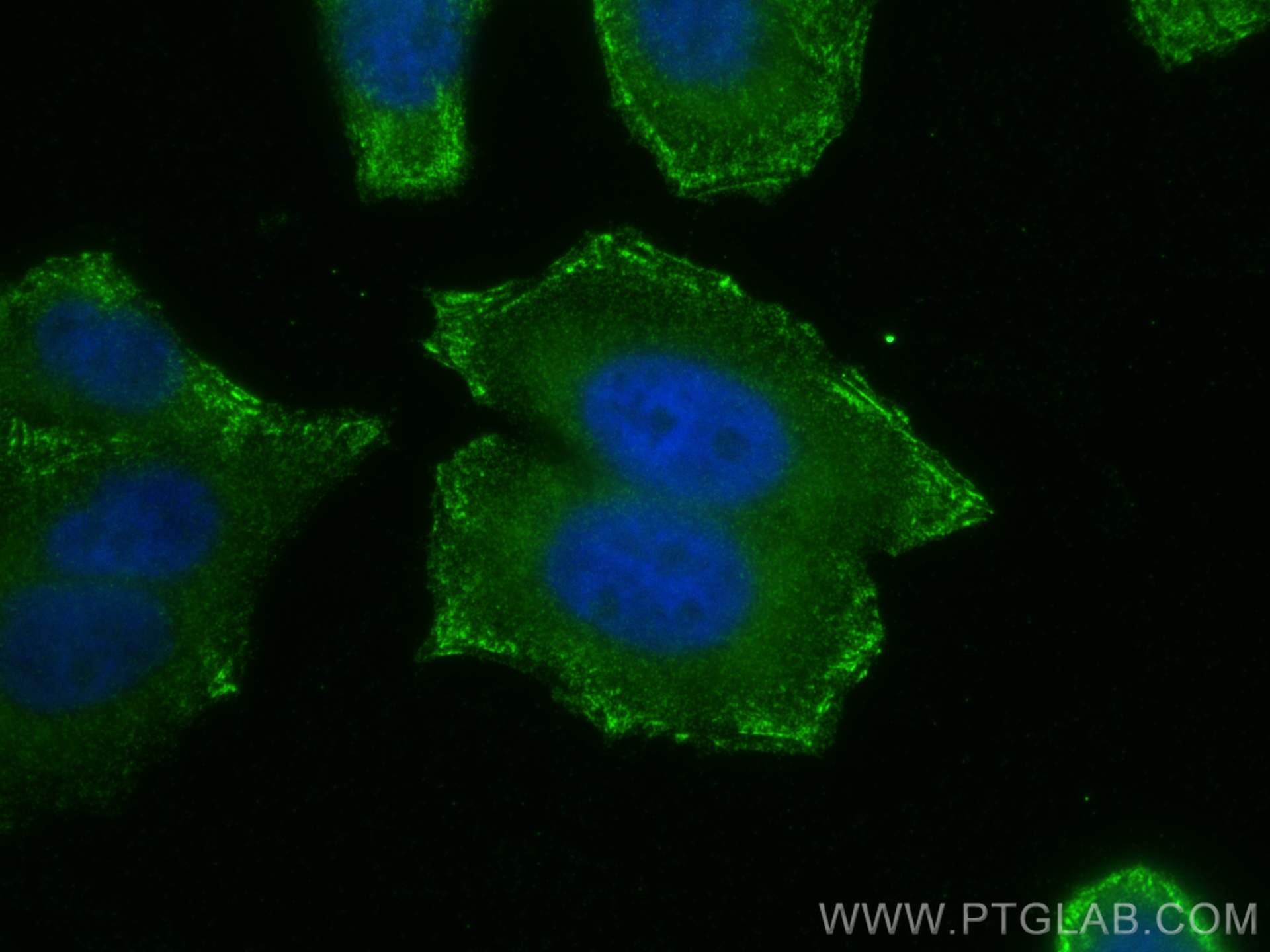 Immunofluorescence (IF) / fluorescent staining of HepG2 cells using Liprin Alpha 1 Polyclonal antibody (14175-1-AP)