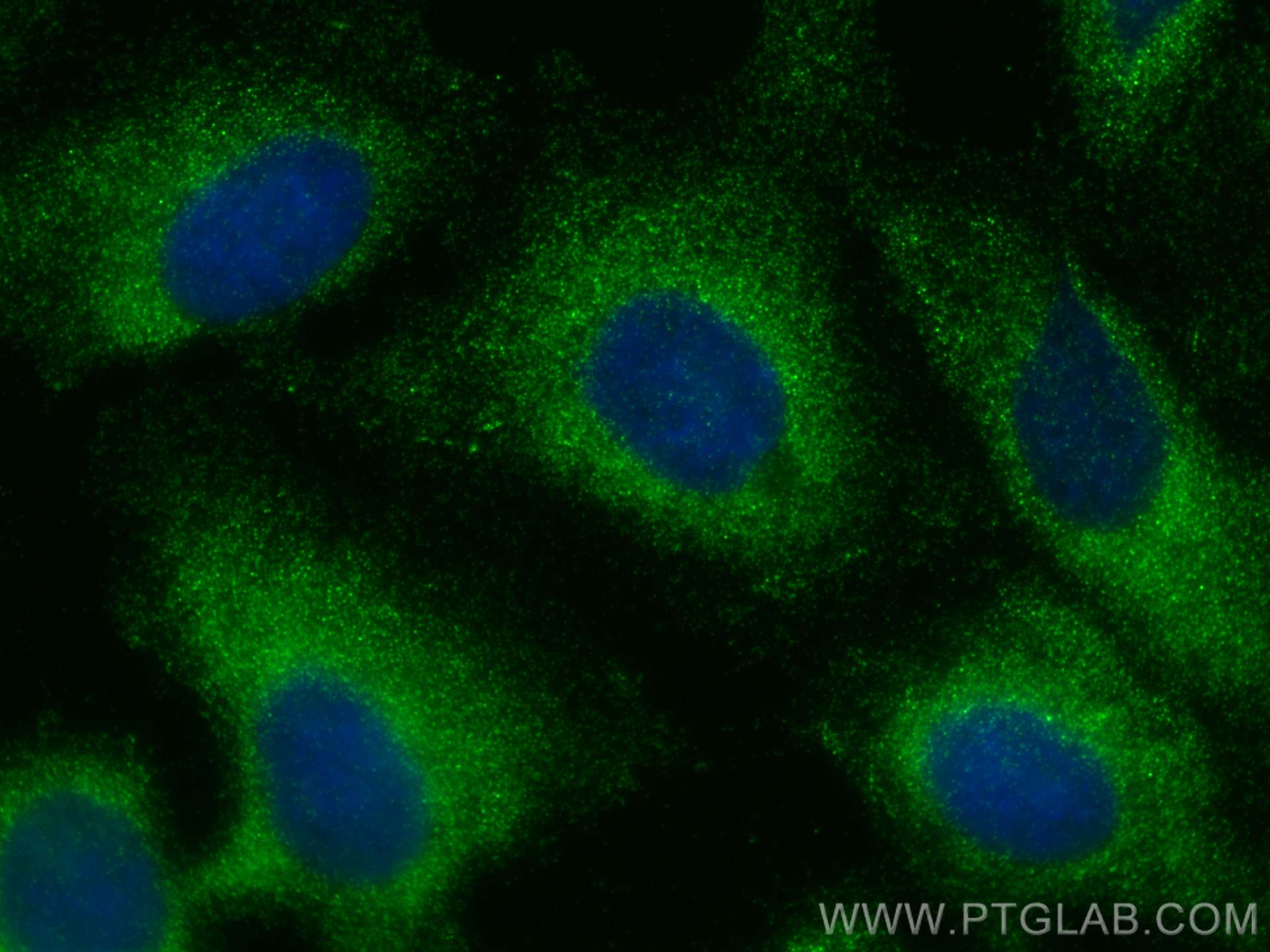 Immunofluorescence (IF) / fluorescent staining of U2OS cells using PPFIBP1 Polyclonal antibody (13961-1-AP)