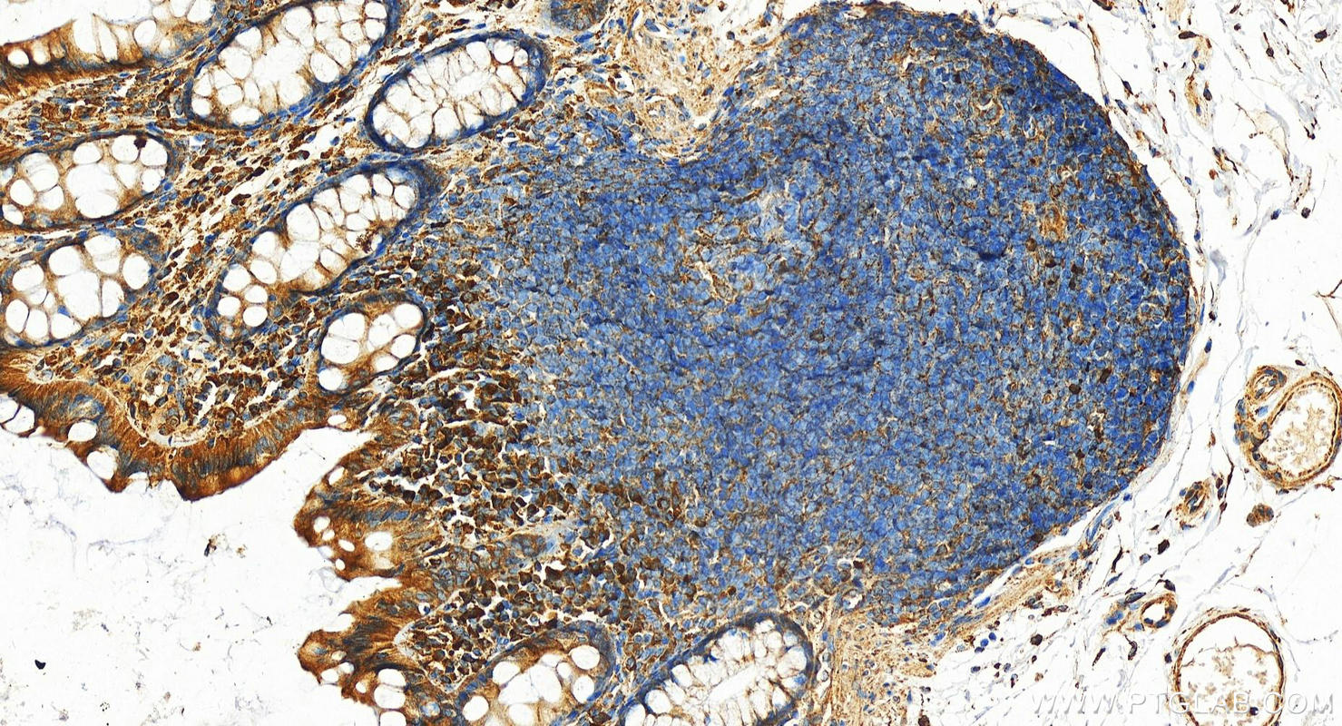 Immunohistochemistry (IHC) staining of human normal colon using Cyclophilin B Polyclonal antibody (11607-1-AP)