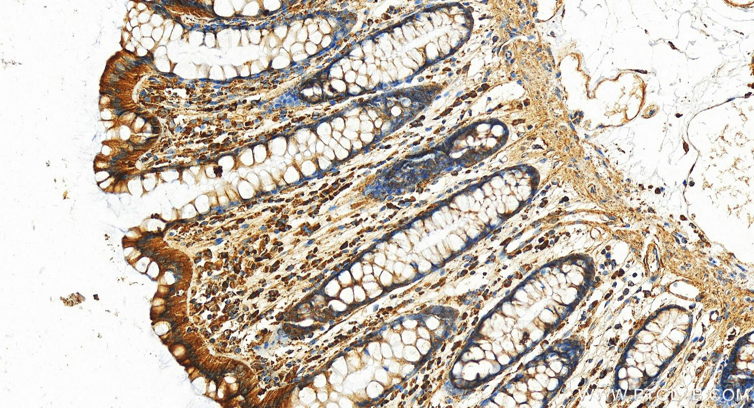 Immunohistochemistry (IHC) staining of human normal colon using Cyclophilin B Polyclonal antibody (11607-1-AP)