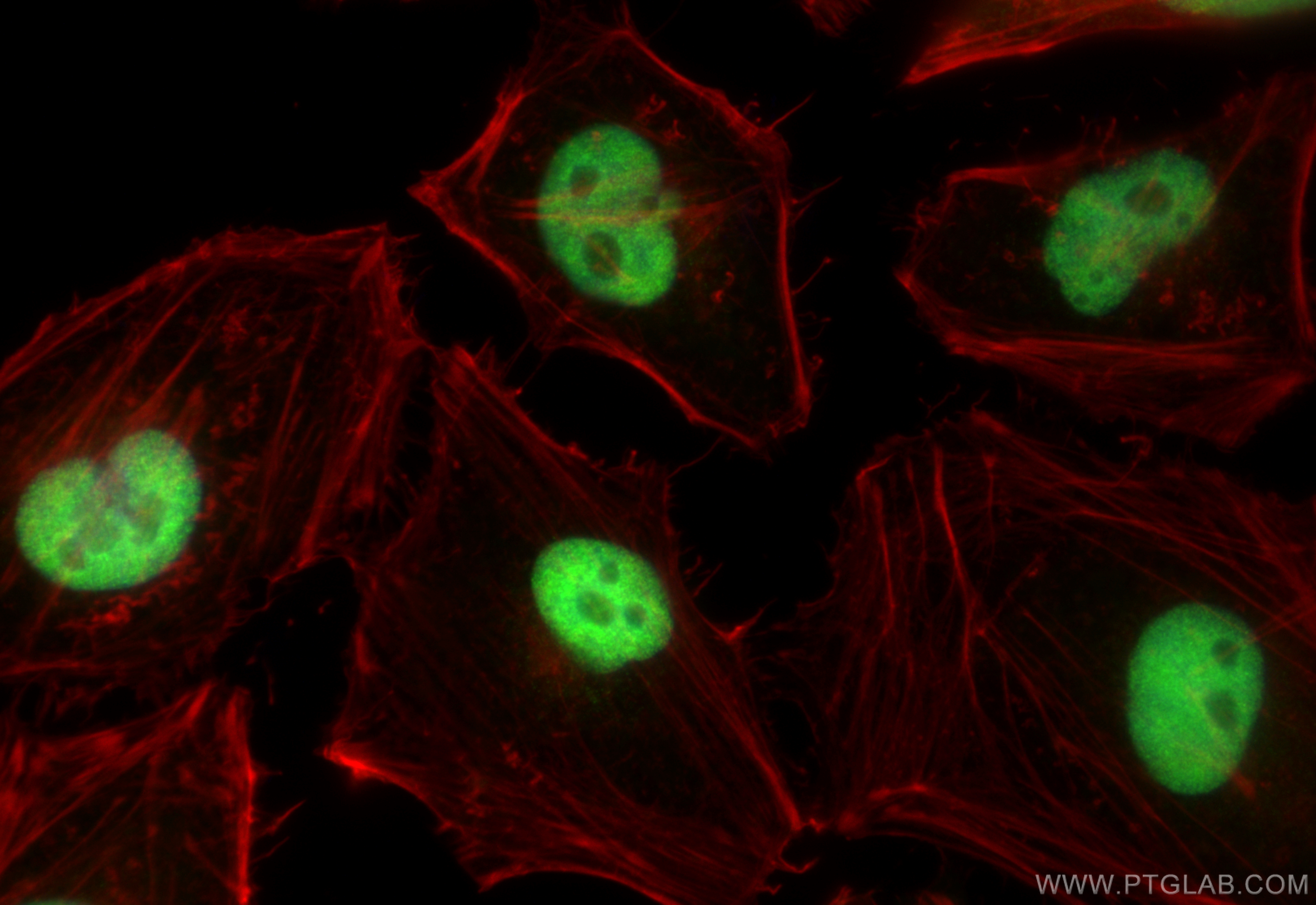 Immunofluorescence (IF) / fluorescent staining of HeLa cells using PPIL4 Polyclonal antibody (12538-1-AP)