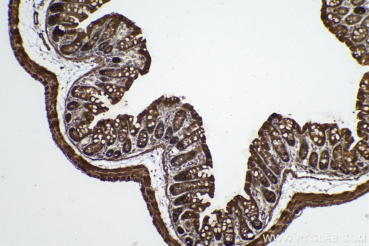 Immunohistochemistry (IHC) staining of mouse colon tissue using PPP1CB Polyclonal antibody (10140-2-AP)