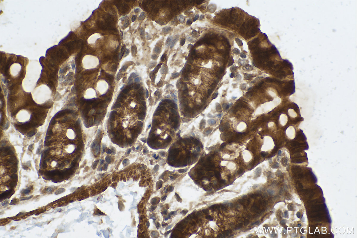 Immunohistochemistry (IHC) staining of mouse colon tissue using PPP1CB Polyclonal antibody (10140-2-AP)