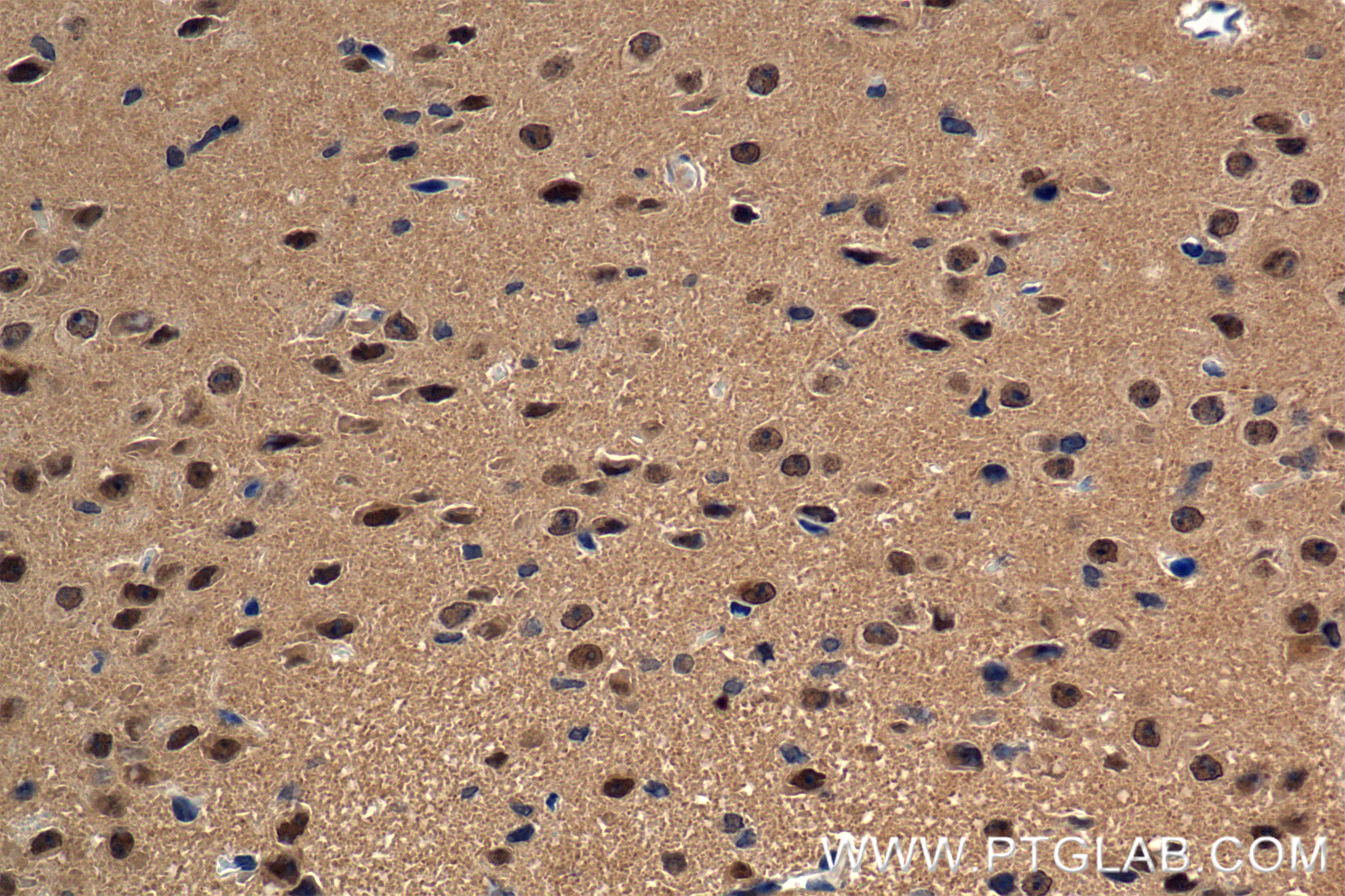 Immunohistochemistry (IHC) staining of mouse brain tissue using PPP1CB Recombinant antibody (84938-5-RR)