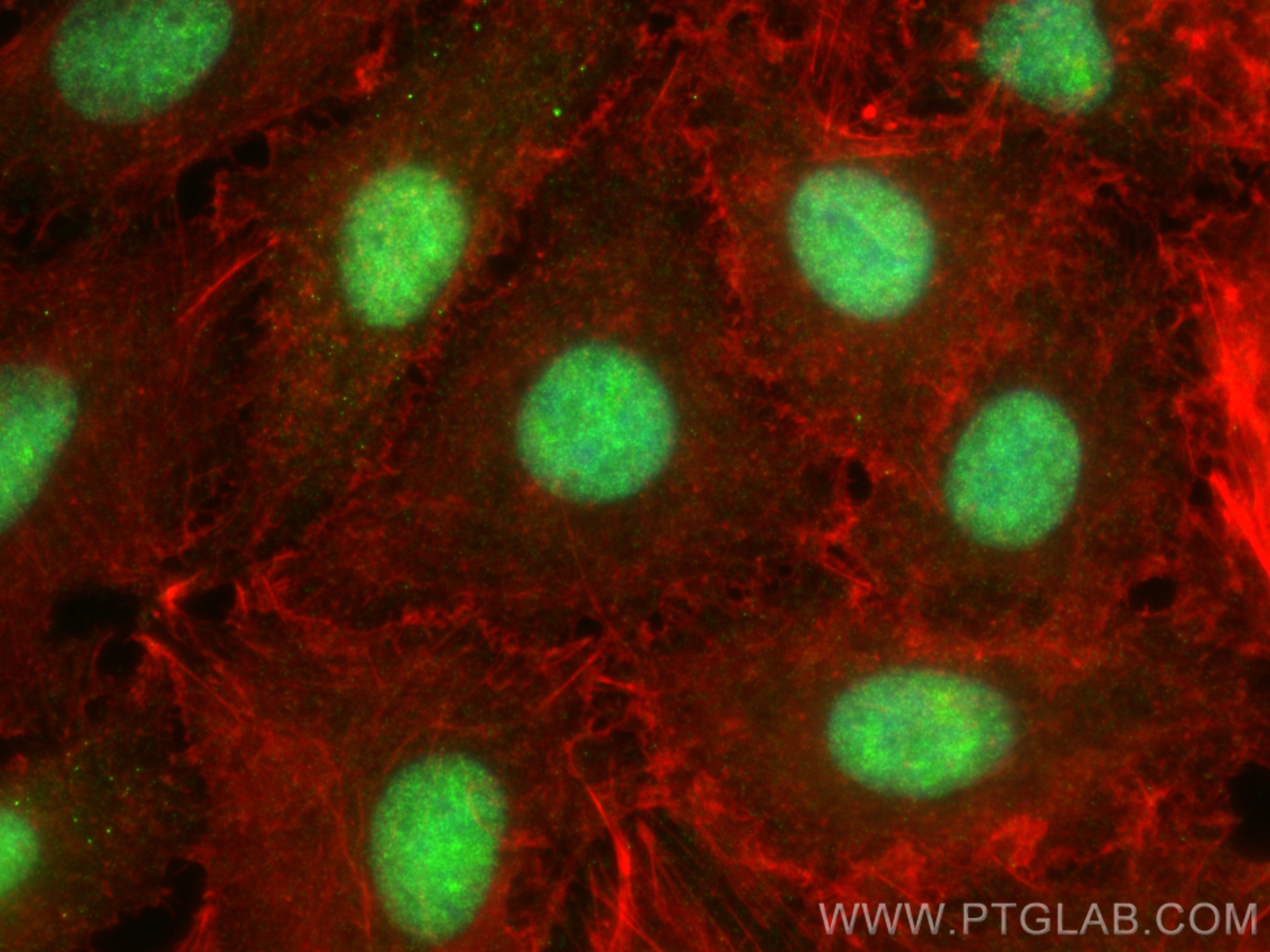 Immunofluorescence (IF) / fluorescent staining of A549 cells using CPI17 Polyclonal antibody (11658-1-AP)