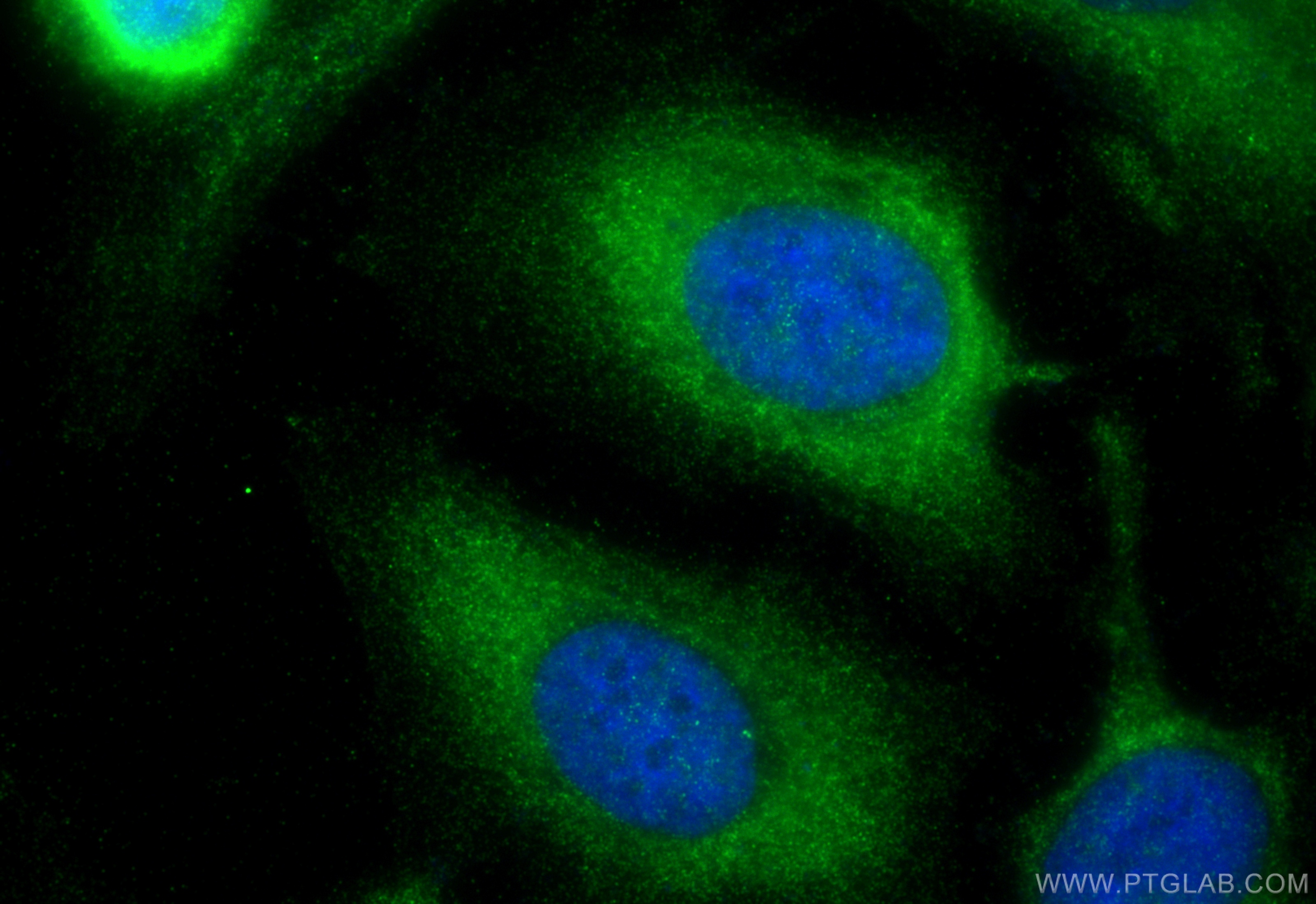 Immunofluorescence (IF) / fluorescent staining of HeLa cells using PPP1R14B Polyclonal antibody (18476-1-AP)