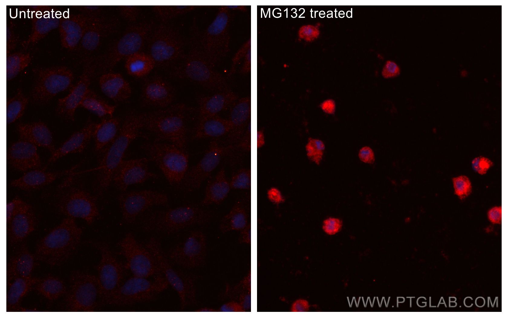 Immunofluorescence (IF) / fluorescent staining of U2OS cells using GADD34 Polyclonal antibody (10449-1-AP)