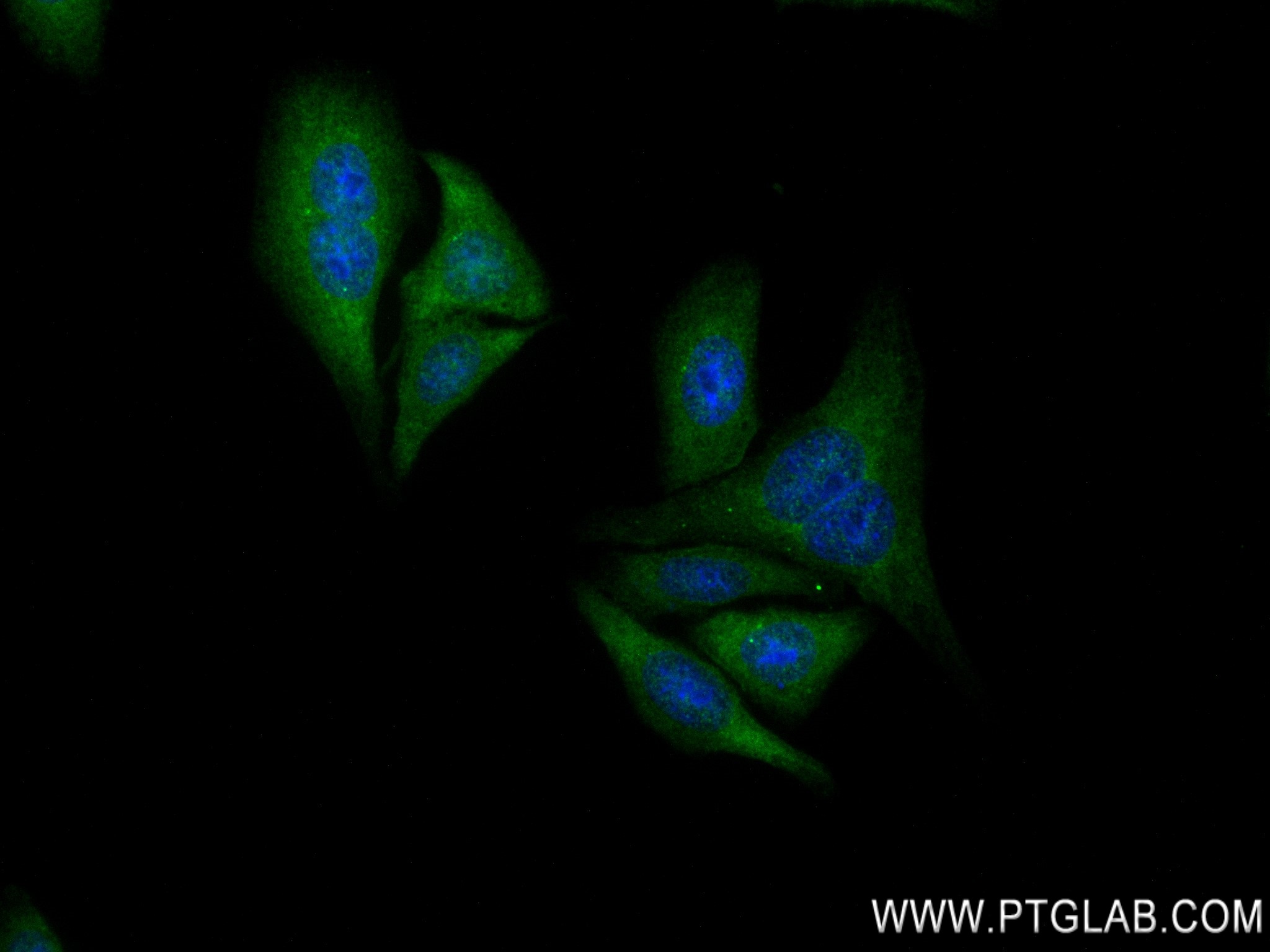 Immunofluorescence (IF) / fluorescent staining of HepG2 cells using PPP1R15B Recombinant antibody (83016-6-RR)