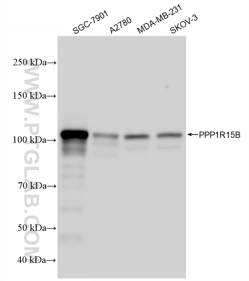 Western Blot (WB) analysis of various lysates using PPP1R15B Recombinant antibody (83016-6-RR)