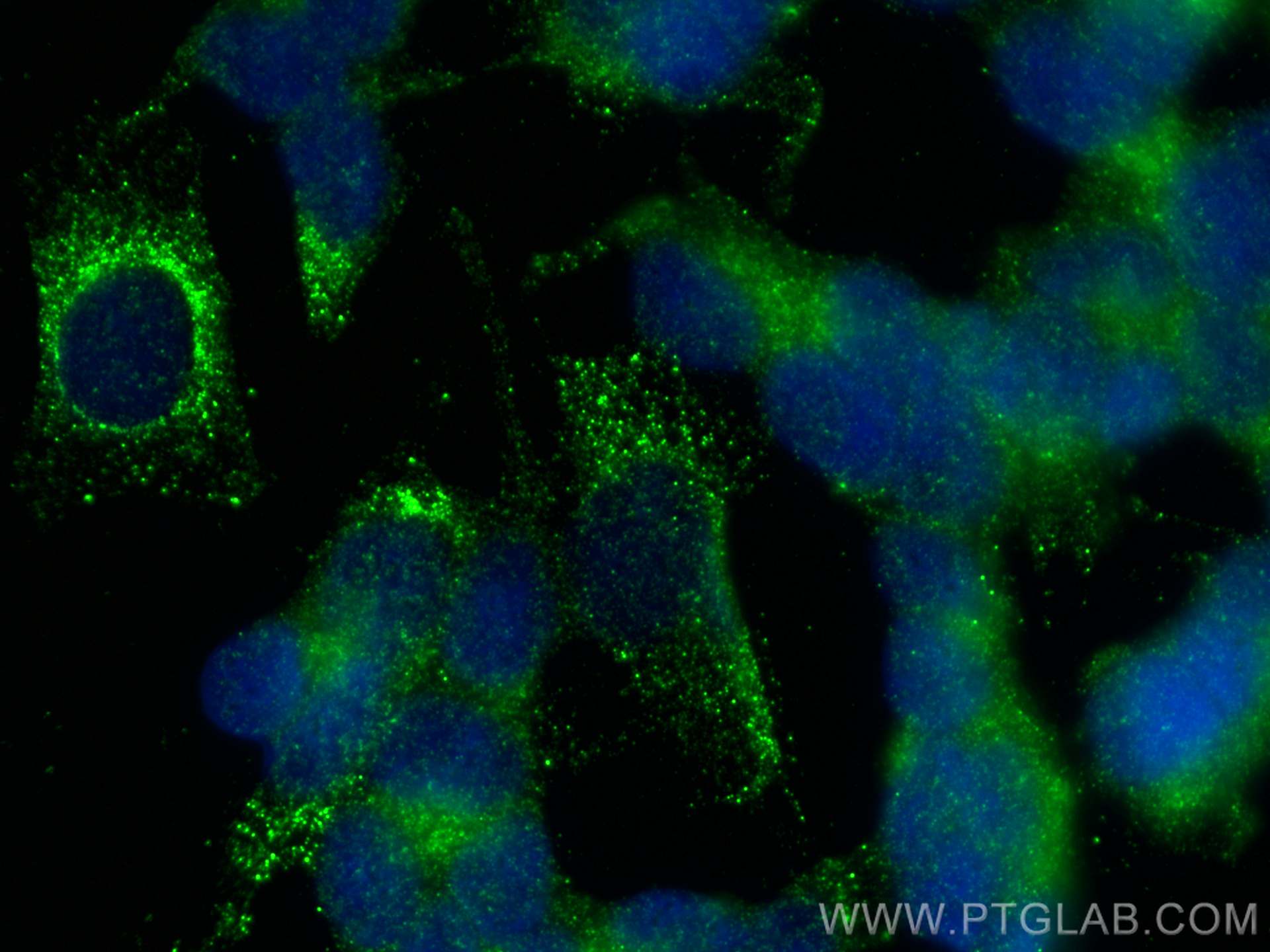 Immunofluorescence (IF) / fluorescent staining of SH-SY5Y cells using DARPP32 Polyclonal antibody (10748-1-AP)