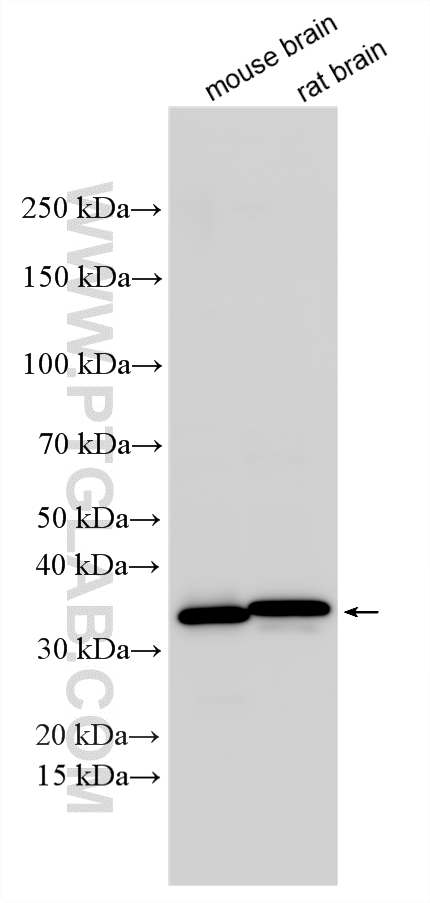 Western Blot (WB) analysis of various lysates using DARPP32 Polyclonal antibody (10748-1-AP)