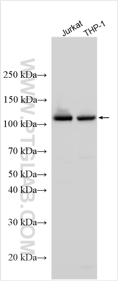Western Blot (WB) analysis of various lysates using PPP1R3A Polyclonal antibody (22495-1-AP)