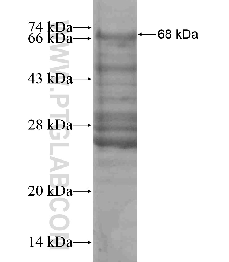 PPP1R3A fusion protein Ag18013 SDS-PAGE