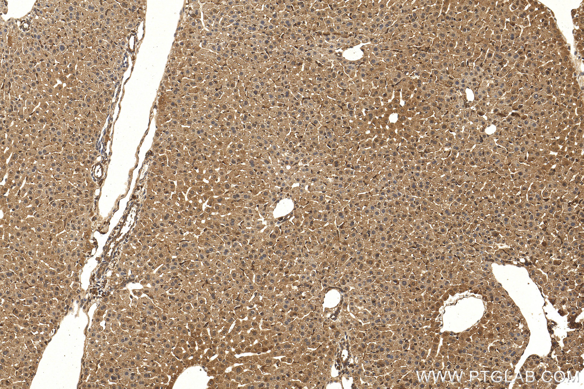 Immunohistochemistry (IHC) staining of mouse liver tissue using PPP2CA Polyclonal antibody (13482-1-AP)