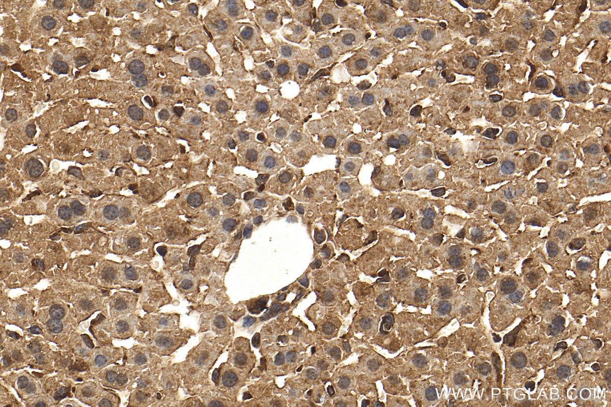 Immunohistochemistry (IHC) staining of mouse liver tissue using PPP2CA Polyclonal antibody (13482-1-AP)