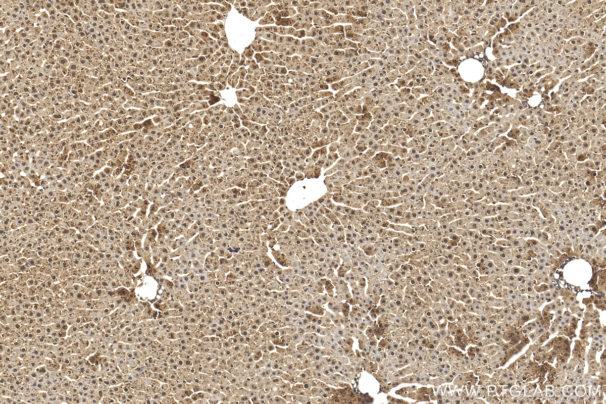 Immunohistochemistry (IHC) staining of rat liver tissue using PPP2CA Polyclonal antibody (13482-1-AP)