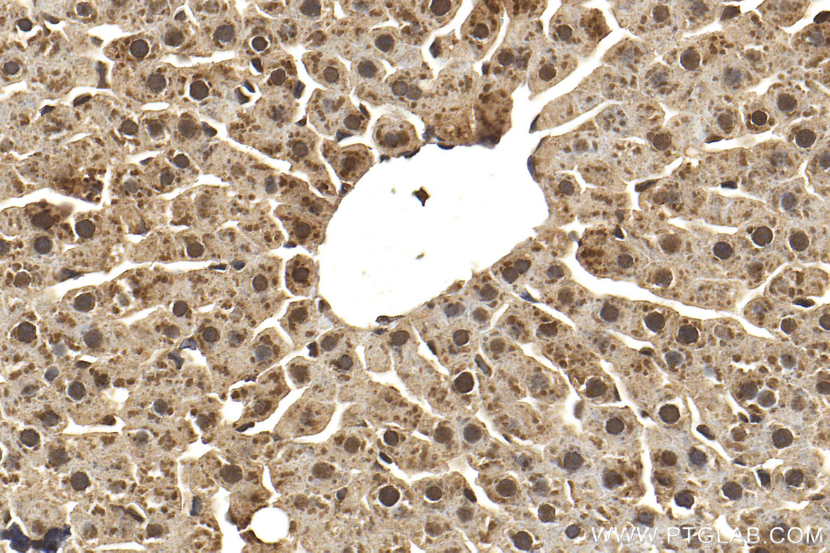 Immunohistochemistry (IHC) staining of rat liver tissue using PPP2CA Polyclonal antibody (13482-1-AP)