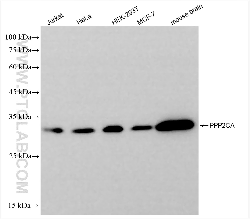 Western Blot (WB) analysis of various lysates using PPP2CA Recombinant antibody (84155-2-RR)