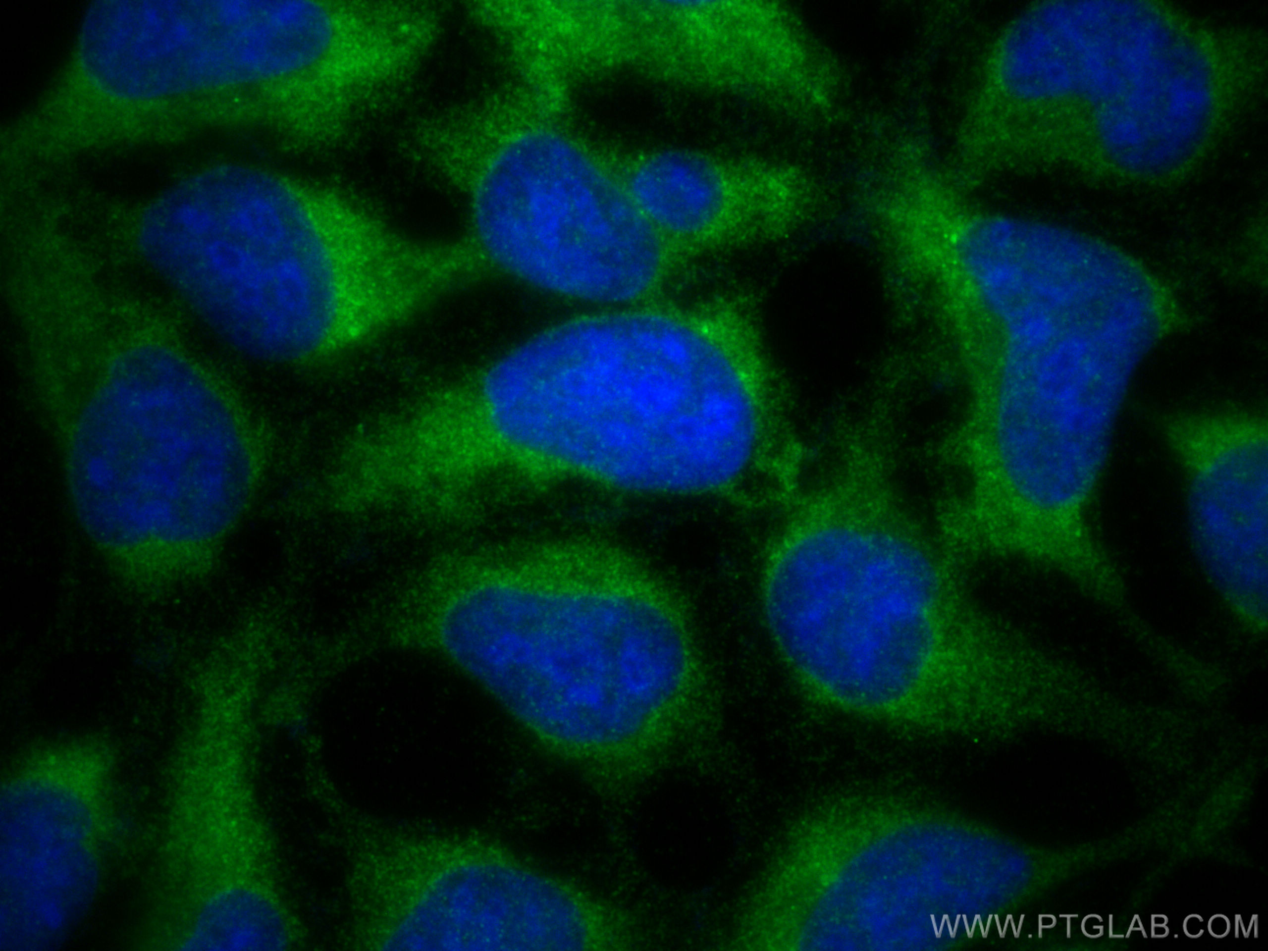 Immunofluorescence (IF) / fluorescent staining of HEK-293 cells using PPP2R1A Polyclonal antibody (15882-1-AP)
