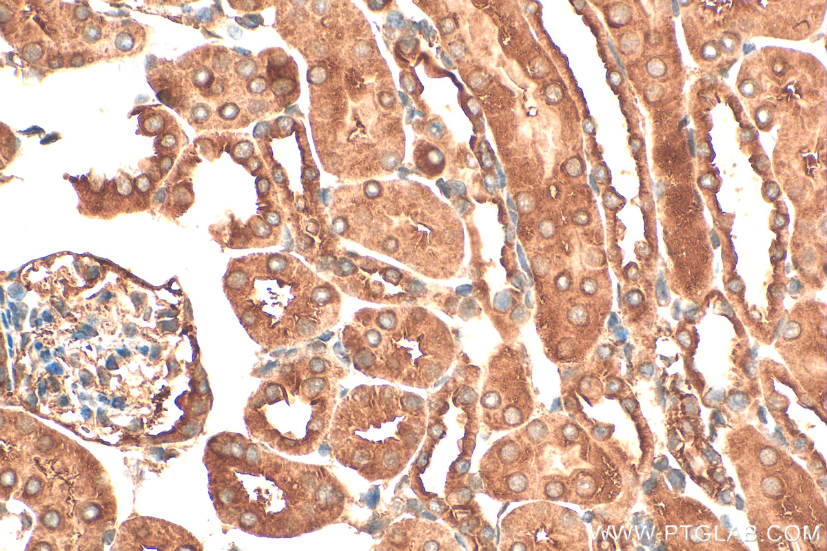 Immunohistochemistry (IHC) staining of mouse kidney tissue using PPP2R1A Polyclonal antibody (15882-1-AP)