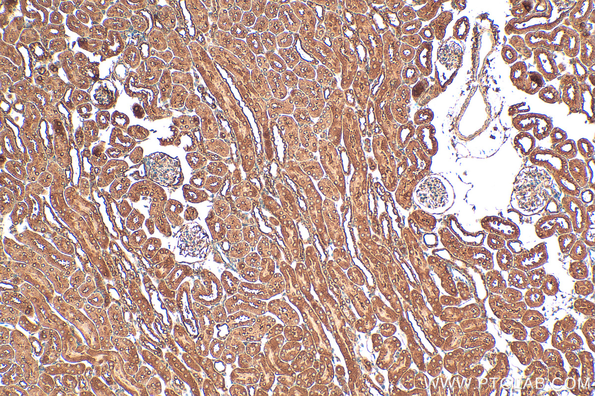 Immunohistochemistry (IHC) staining of mouse kidney tissue using PPP2R1A Polyclonal antibody (15882-1-AP)