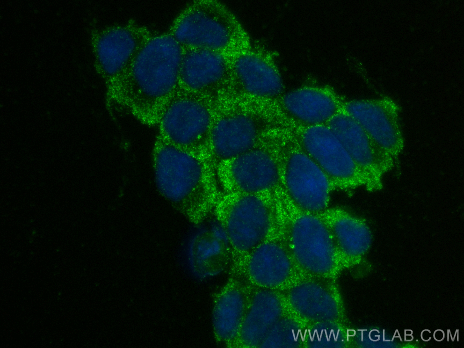 Immunofluorescence (IF) / fluorescent staining of SH-SY5Y cells using PPP2R2A/B/C Monoclonal antibody (67783-1-Ig)