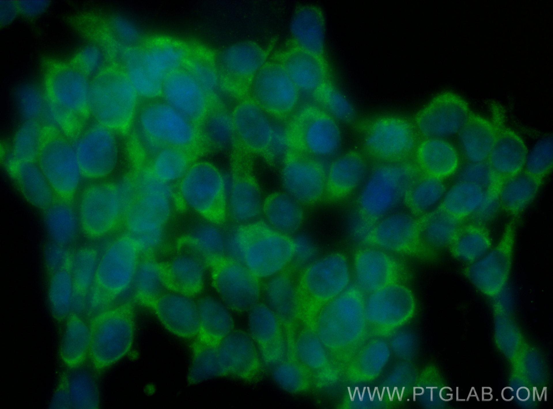 Immunofluorescence (IF) / fluorescent staining of SH-SY5Y cells using CoraLite® Plus 488-conjugated PPP2R2A/B/C Monoclon (CL488-67783)