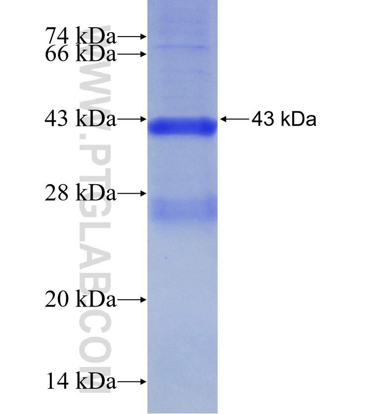 PPP2R2B fusion protein Ag30757 SDS-PAGE