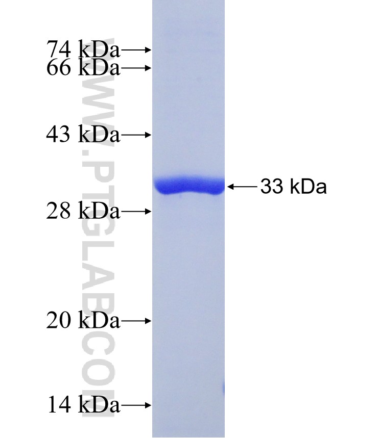 PPP2R5A fusion protein Ag31072 SDS-PAGE