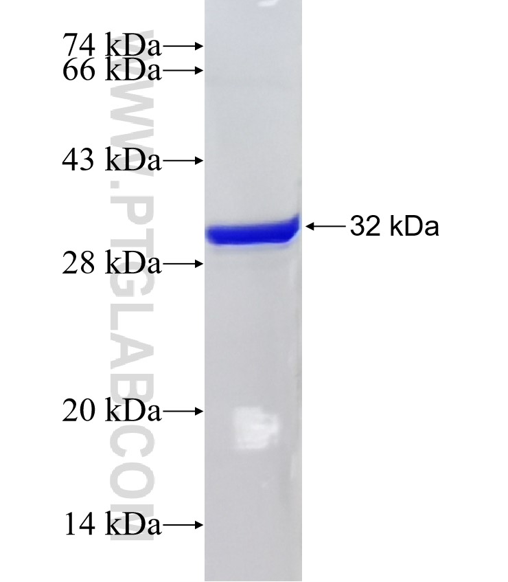 PPP2R5B fusion protein Ag25928 SDS-PAGE