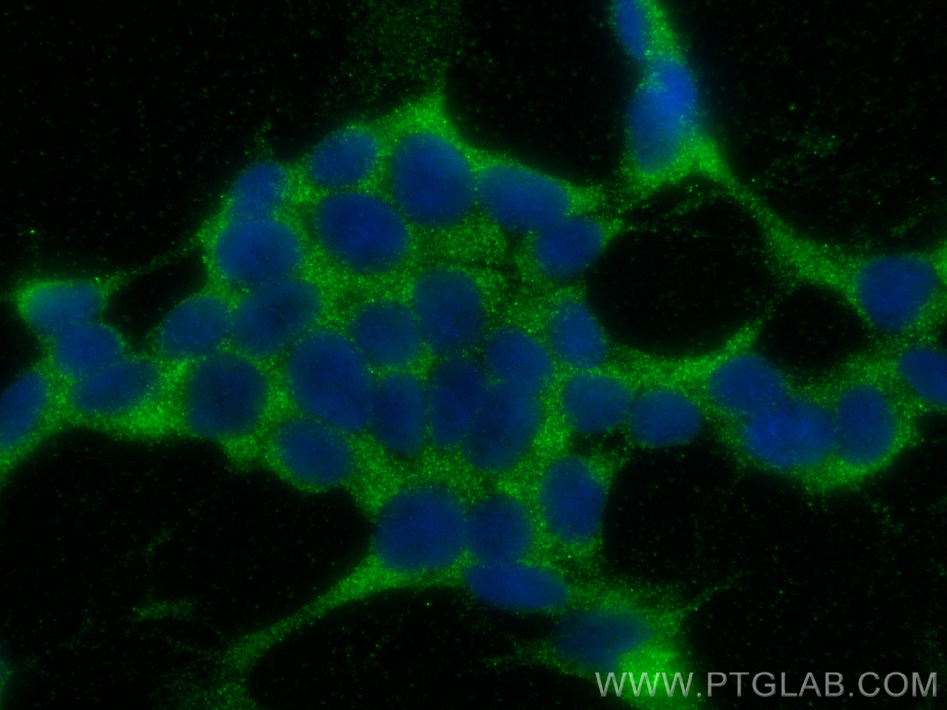 Immunofluorescence (IF) / fluorescent staining of SH-SY5Y cells using PPP3CA Polyclonal antibody (13422-1-AP)