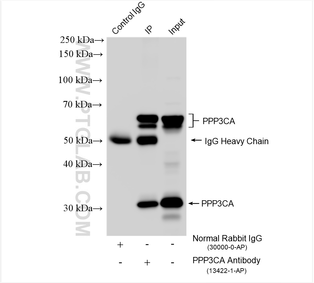 Immunoprecipitation (IP) experiment of mouse brain tissue using PPP3CA Polyclonal antibody (13422-1-AP)