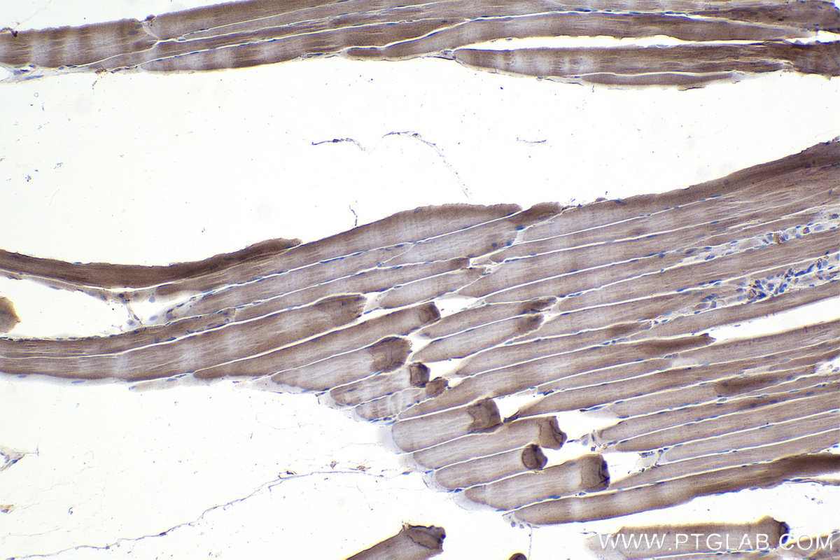 Immunohistochemistry (IHC) staining of rat skeletal muscle tissue using PPP3CA Monoclonal antibody (68163-1-Ig)