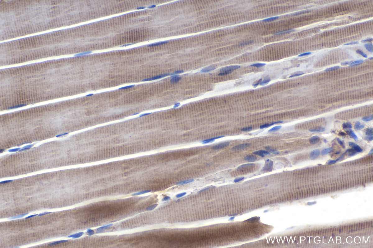 Immunohistochemistry (IHC) staining of rat skeletal muscle tissue using PPP3CA Monoclonal antibody (68163-1-Ig)