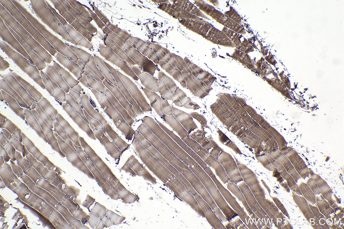 Immunohistochemistry (IHC) staining of mouse skeletal muscle tissue using PPP3CA Monoclonal antibody (68163-1-Ig)