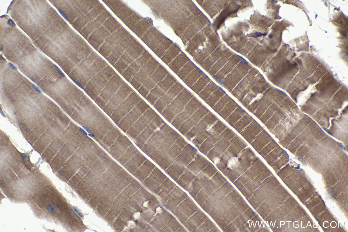 Immunohistochemistry (IHC) staining of mouse skeletal muscle tissue using PPP3CA Monoclonal antibody (68163-1-Ig)