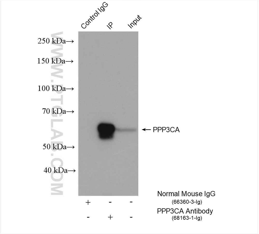 Immunoprecipitation (IP) experiment of rat brain tissue using PPP3CA Monoclonal antibody (68163-1-Ig)