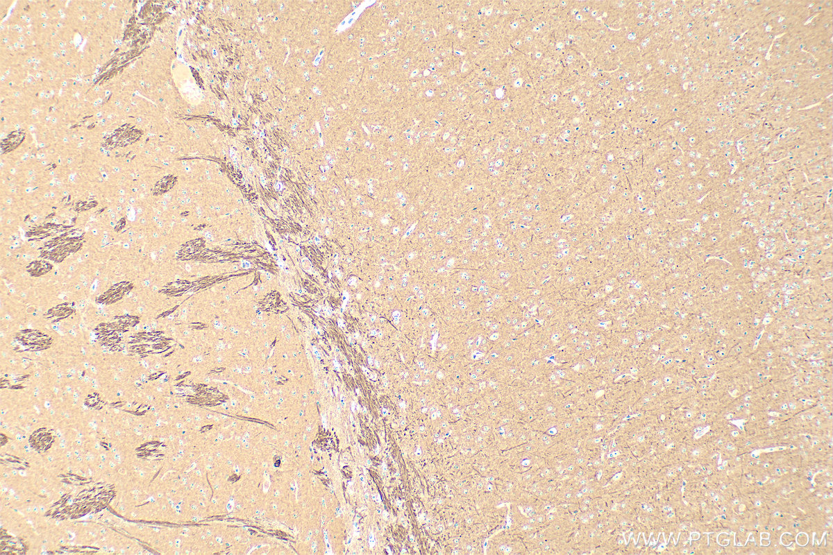 Immunohistochemistry (IHC) staining of mouse brain tissue using PPP3CB Polyclonal antibody (13340-1-AP)