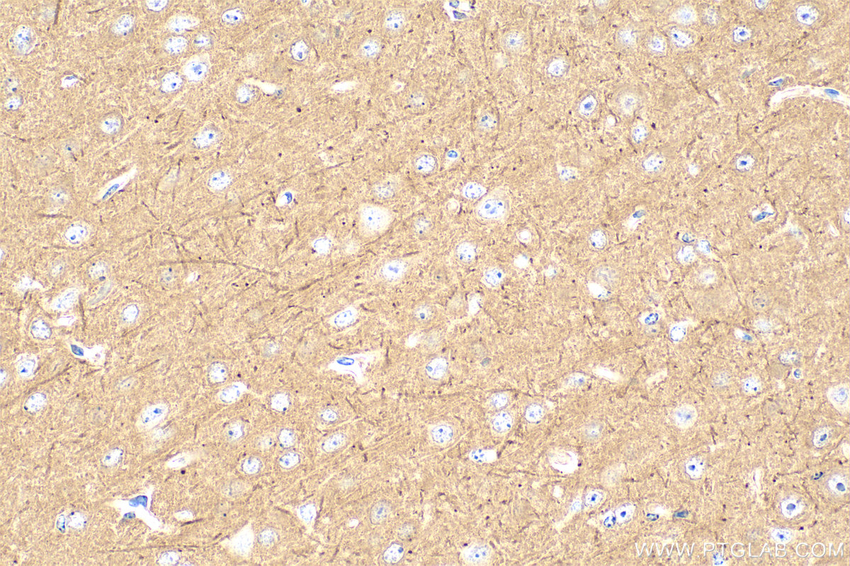 Immunohistochemistry (IHC) staining of mouse brain tissue using PPP3CB Polyclonal antibody (13340-1-AP)