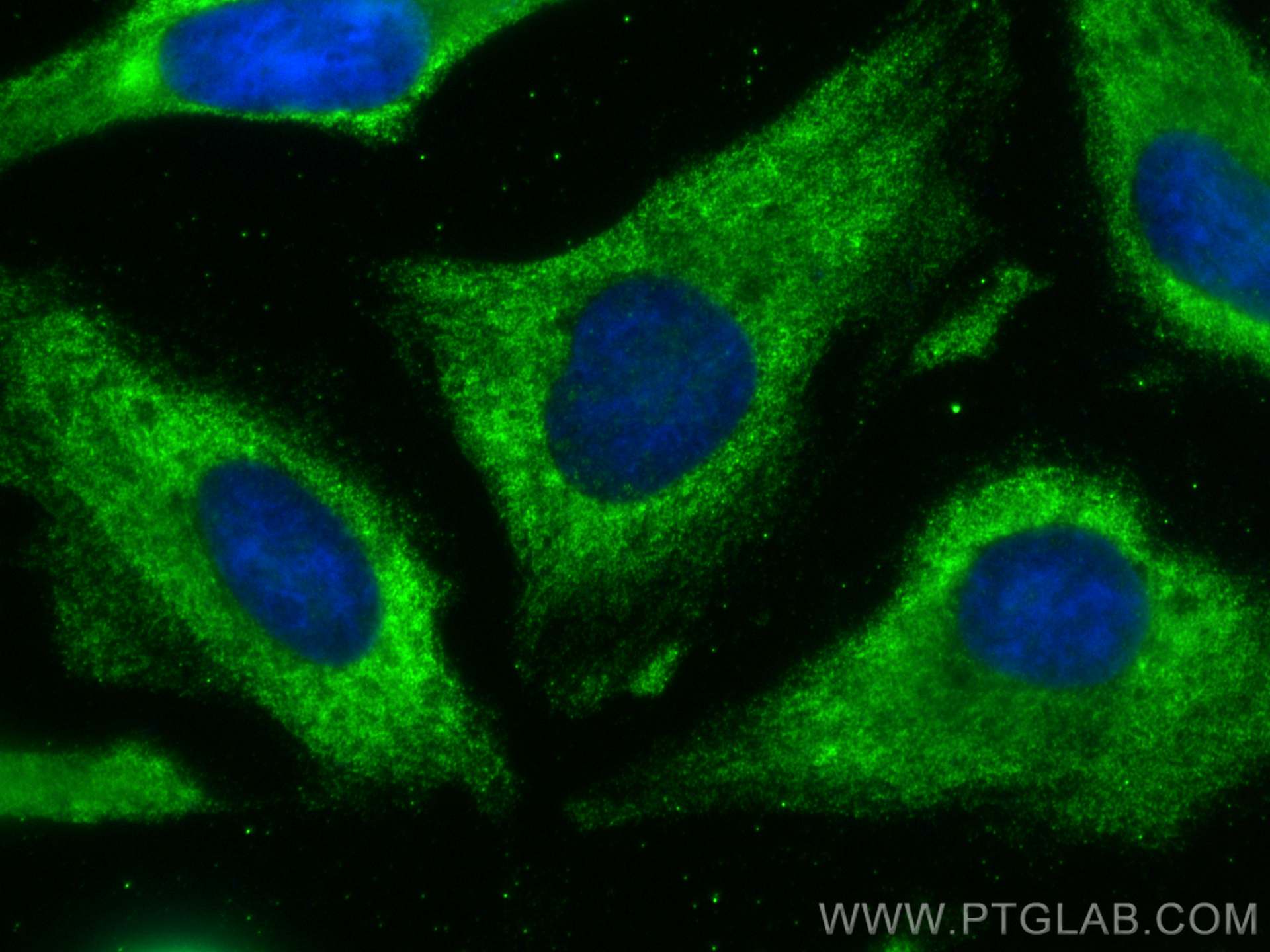 Immunofluorescence (IF) / fluorescent staining of HeLa cells using PPP3CB Monoclonal antibody (66614-1-Ig)