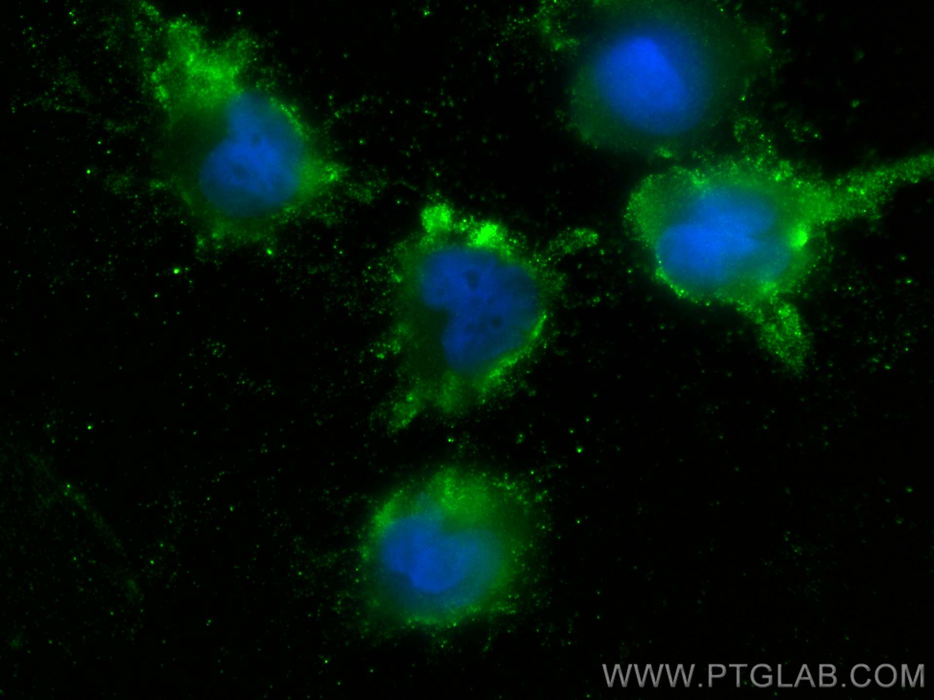 Immunofluorescence (IF) / fluorescent staining of U-251 cells using PPP3CB Monoclonal antibody (66614-1-Ig)