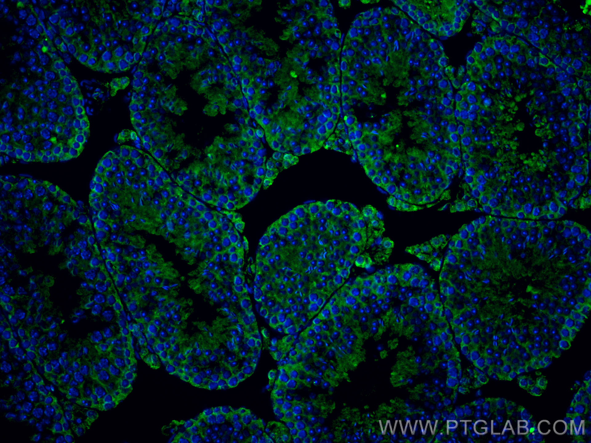 Immunofluorescence (IF) / fluorescent staining of mouse testis tissue using PPT1 Monoclonal antibody (67699-1-Ig)