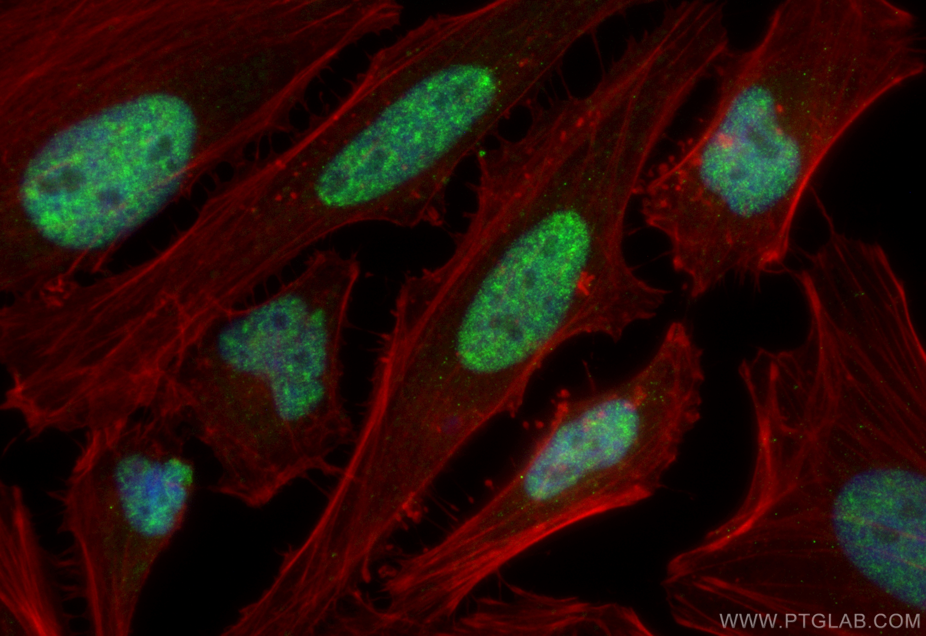 Immunofluorescence (IF) / fluorescent staining of HeLa cells using CoraLite® Plus 488-conjugated PQBP1 Recombinant an (CL488-84491-6)