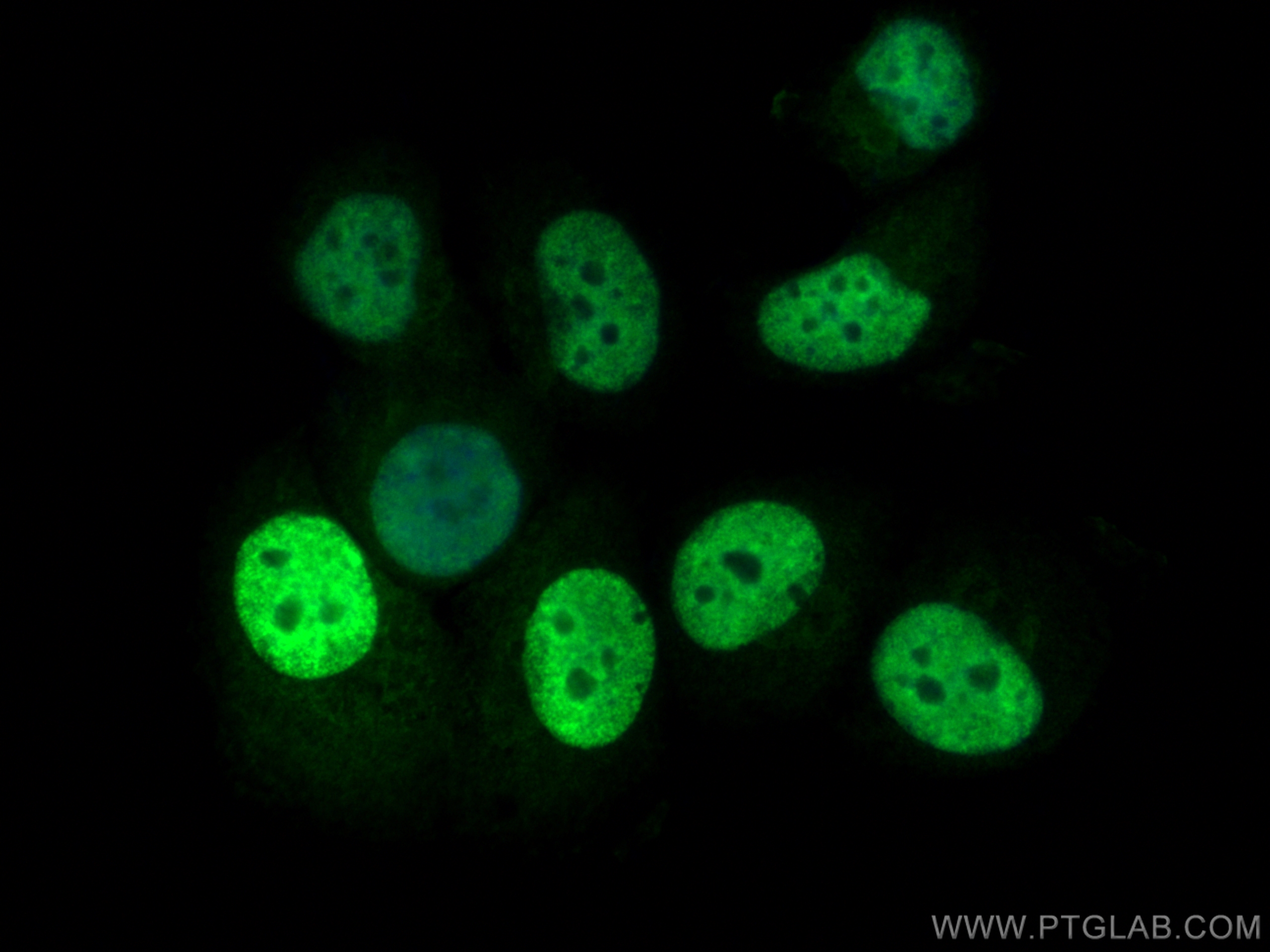 Immunofluorescence (IF) / fluorescent staining of T-47D cells using PR Polyclonal antibody (25871-1-AP)